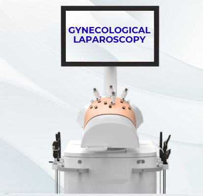 Gynecological Laparoscopy By Dr. YuvrajSingh Jadeja
